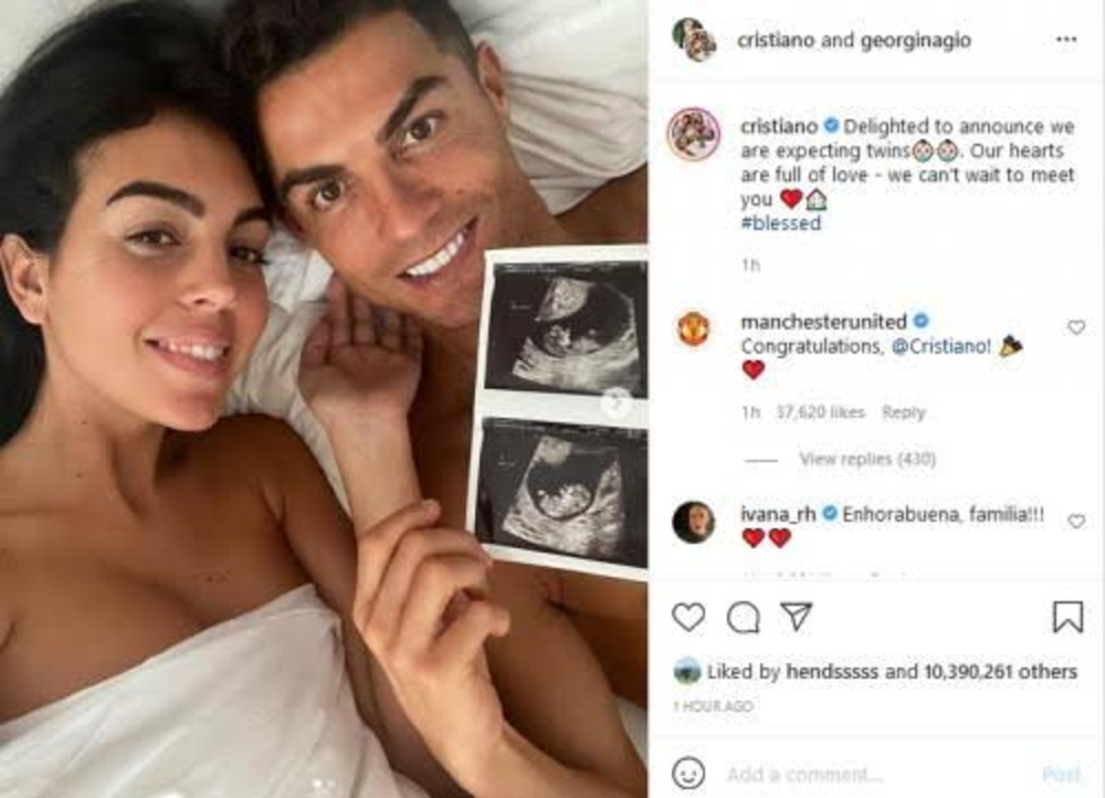 Ronaldo Bakal Momong Anak Kembar