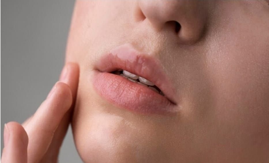 Tips mengatasi pigmentasi bibir yang bisa dilakukan di rumah.