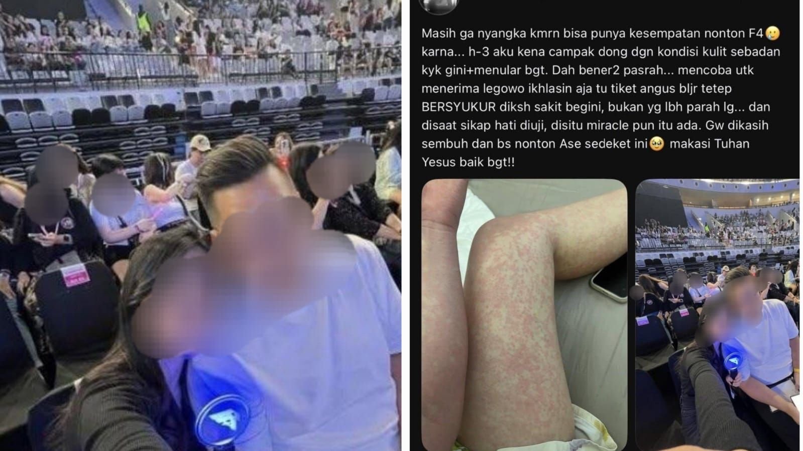 Viral cerita penonton konser F4 Jakarta yang mengaku sakit campak.